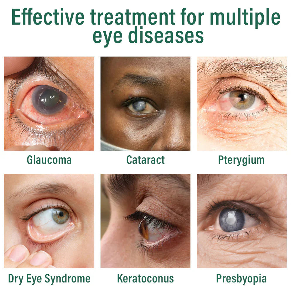 ✅Nano Eye Drops Serum 👩‍⚕️Suitable for presbyopia, dry eye syndrome, glaucoma, and cataracts 🦘