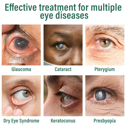 ✅Nano Eye Drops Serum 👩‍⚕️Suitable for presbyopia, dry eye syndrome, glaucoma, and cataracts 🦘